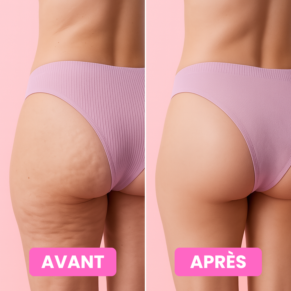 Crème Anti-Cellulite 100% Naturelle Slimélia®