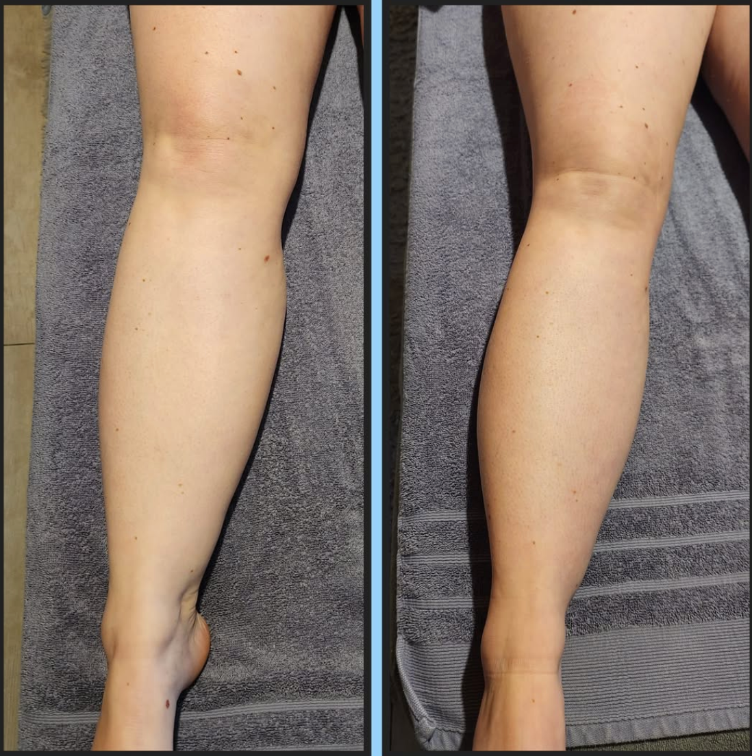 Slimélia® : Cure Détox Drainante 100% Naturelle