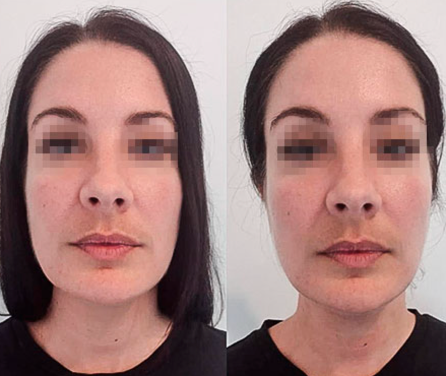 Slimélia® : Cure Détox Drainante 100% Naturelle